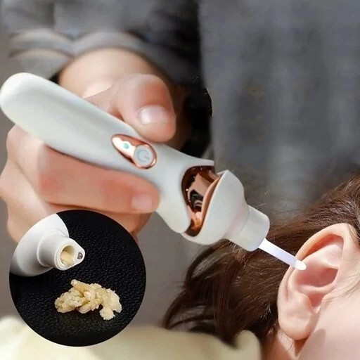 گوش پاک کن برقی کد ۷۱۸۷